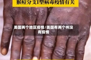 美国两个地区疫情/美国有两个州没有疫情